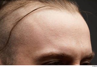 HD Face Skin John Hopkins eyebrow face forehead skin pores…